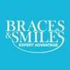 Braces n Smiles